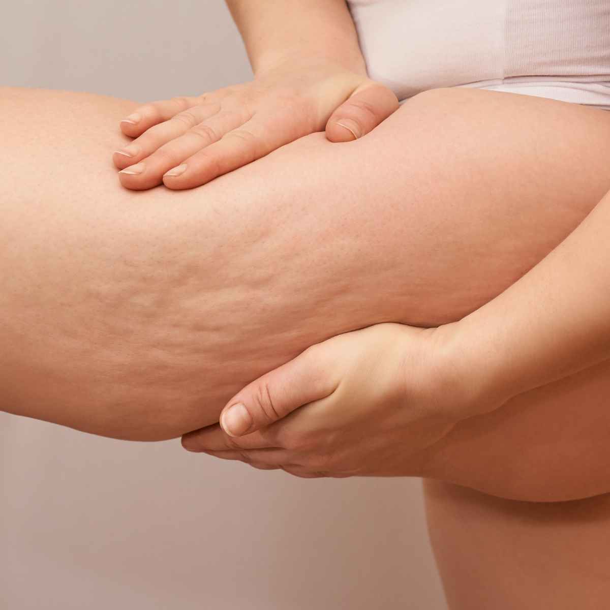 Imagen procedimiento celulitis