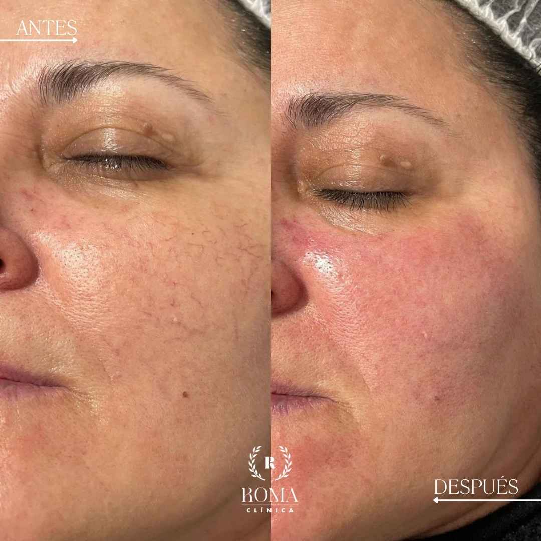 Imagen antes y después procedimiento paciente