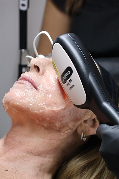 Profesional de estética realizando sesión de Alma Harmony para mejorar firmeza y luminosidad del rostro