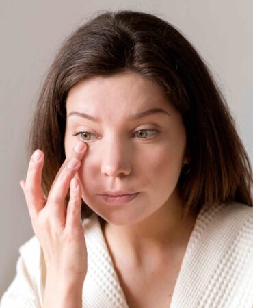 Disminuye los signos del cansancio y la edad con nuestro procedimiento de relleno de ojeras