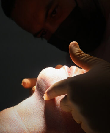 El mejor procedimiento de armonización facial en malaga