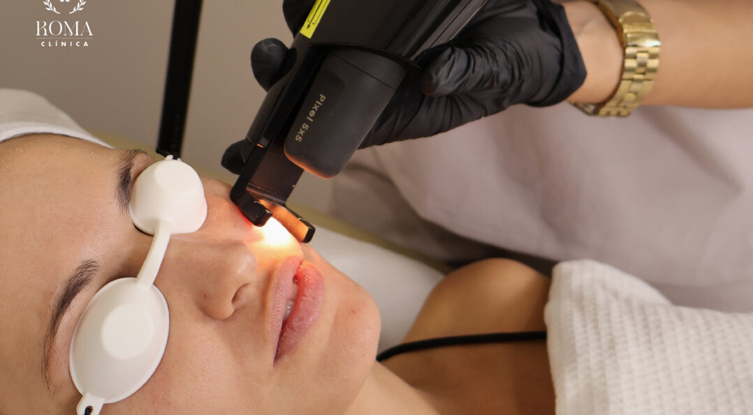 Los mejores tratamientos para cuidar tu piel en esta temporada navideña