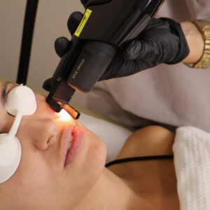 Los mejores tratamientos para cuidar tu piel en esta temporada navideña