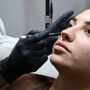 Clínica Roma Málaga, la mejor opción para tu belleza