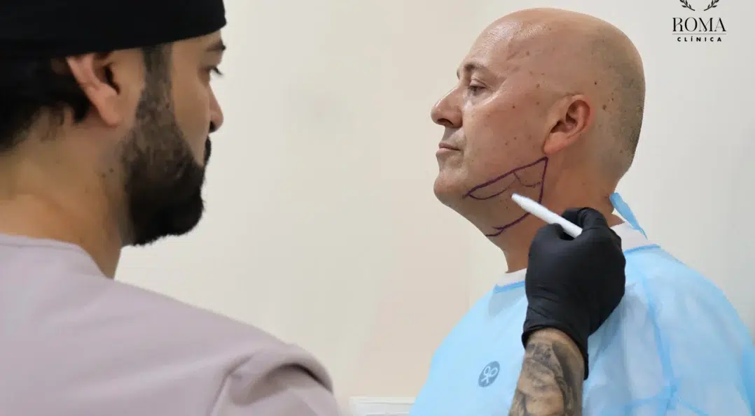 Lipopapada en Málaga