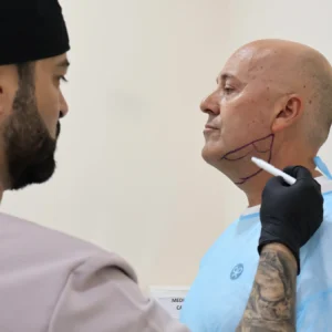 Lipopapada en Málaga