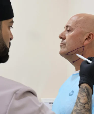 Lipopapada en Málaga