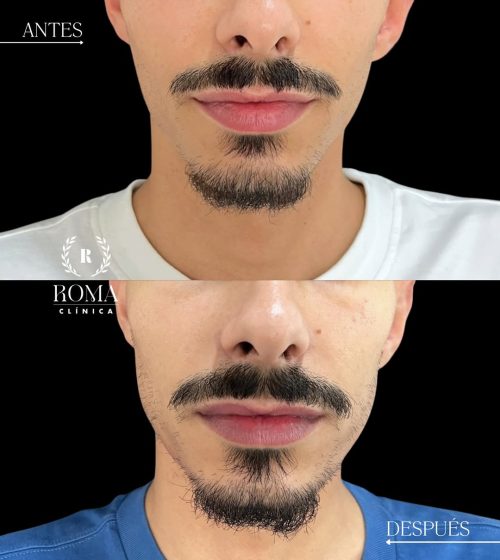 550684461_17942279286053293_1302781896506951741_n