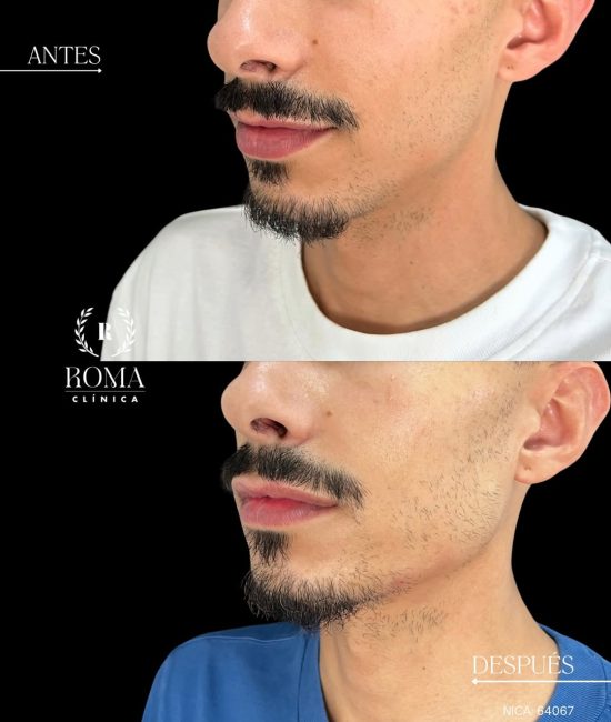 551065095_17942279295053293_3123546306187857748_n