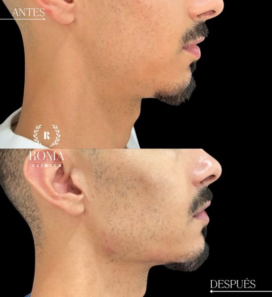 551075568_17942279283053293_2120331928153109517_n